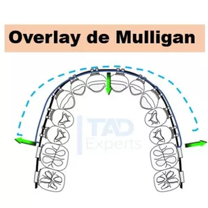 Imagen de portada para Curso online Overlay de Mulligan de la A a la Z