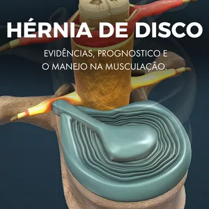 Imagem de capa para o Ebook Hérnia de disco - Evidências, prognostico e o manejo na musculação. 
