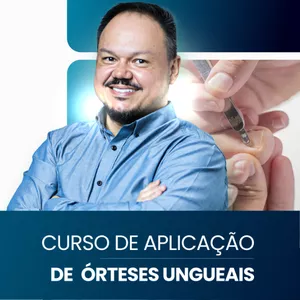 Imagem do curso Curso de Aplicação de Órteses Ungueais na Prática