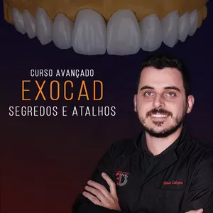 Imagem de capa para o Curso online Exocad Segredos e Atalhos - Avançado