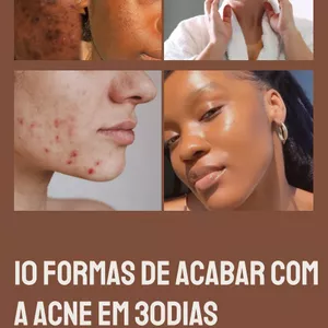 Imagem de capa para o Curso online 10 Formas De Acabar Com a Acne em 30 Dias