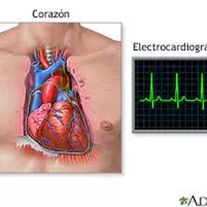 Imagen de portada para Ebook ECG POWER REPASO