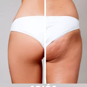 Imagen de portada para Ebook Adiós Celulitis