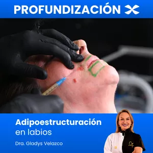 Imagen de portada para Curso online Adipoestructuración en labios