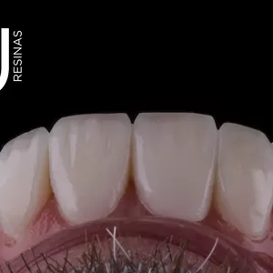 Imagem do curso Lentes de Resina - Yu resinas 