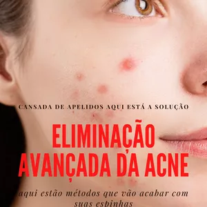 Imagem de capa para o Ebook ELIMINAÇÃO AVANÇADA DA ACNE