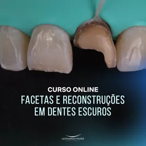 Imagem principal do produto Curso Online Facetas e Reconstruções em Dentes Escuros