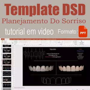 Imagem de capa para o Ebook Template DSD - Planejamento do Sorriso para PowerPoint: Transforme Suas Apresentações Odontológicas
