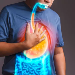 Imagen de portada para Ebook CERO ARDOR