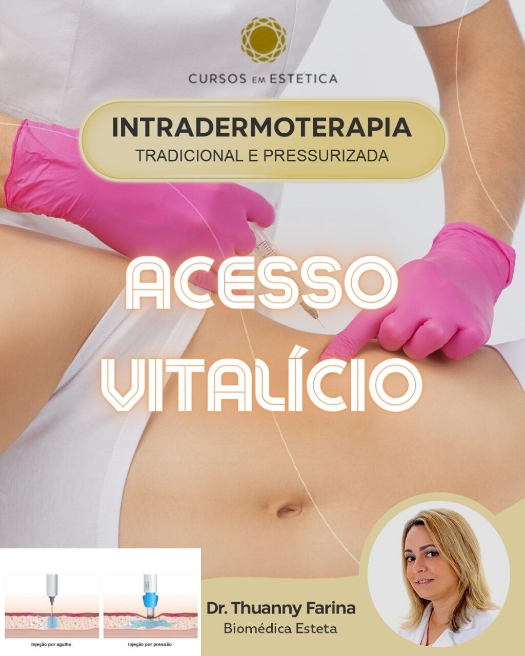 Imagem do curso  - Intradermoterapia Completa - Adicional Acesso Vitalício