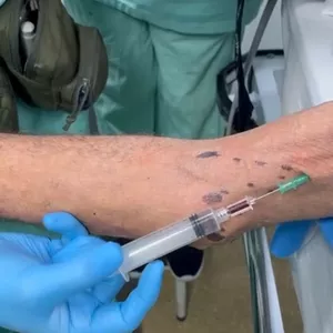 Imagem de capa para o Curso online A PUNÇÃO DA VEIA BASÍLICA