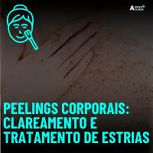 Imagem de capa para o Curso online Curso de Peelings Corporais: Clareamento e Tratamento de Estrias