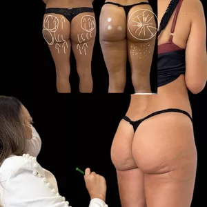 Imagem de capa para o Curso online Gluteos on line 