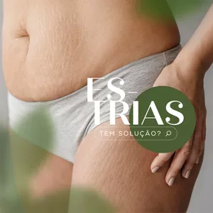 Imagem de capa para o Ebook Estria nunca mais