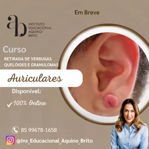 Imagem de capa para o Curso online Curso de Retirada de Verrugas, queloides e granulomas auriculares