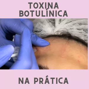 Curso Curso Toxina Botulínica na Prática