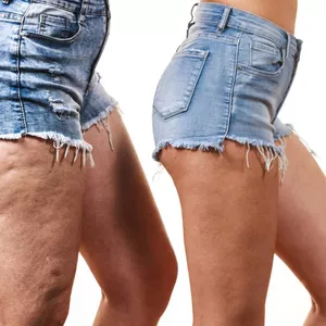 Imagen de portada para Curso online ELIMINANDO AS CELULITE