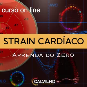 Imagem de capa para o Curso online Curso Online: Strain Cardíaco - Aprenda do Zero