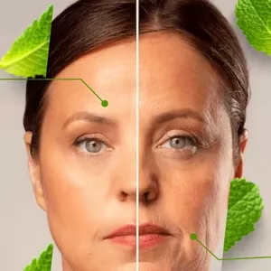 Imagem de capa para o Curso online Zero Rugas