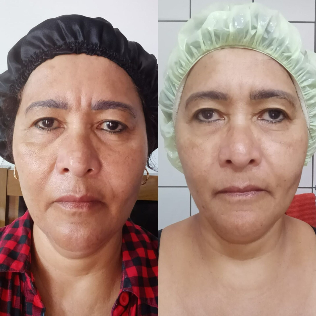 Denise, 63 anos