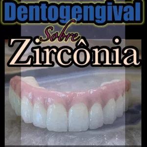 Imagem do curso Protocolo Dentogengival sobre zircônia 