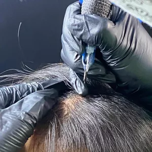 Imagen de portada para Curso online Curso de Micropuntura Brasileña: Regeneración Capilar Efectiva