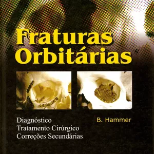 Imagem de capa para o Ebook Fraturas Orbitárias - B. Hammer