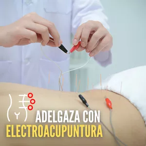 Imagen de portada para Curso online Adelgaza con electroacupuntura