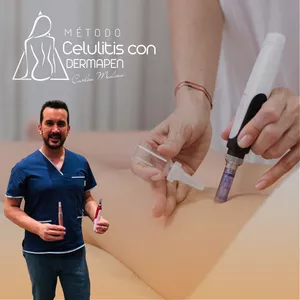 Imagen de portada para Curso online Método celulitis con dermapen 