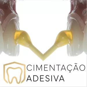 Imagem de capa para o Curso online Cimentação adesiva em Odontologia