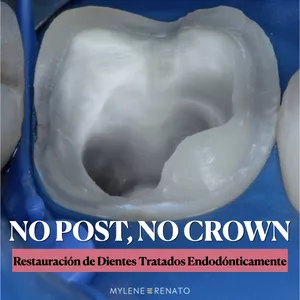 Imagen de portada para Curso online No Post, No Crown (Español)