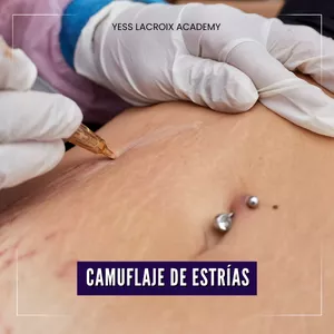 Imagen de portada para Curso online 🎓CAMUFLAJE DE ESTRÍAS YESS LACROIX