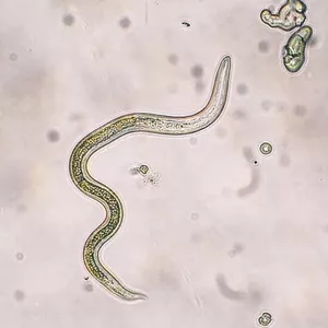 Imagem de capa para o Curso online Enfermidades Parasitárias