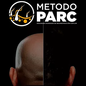 Imagen de portada para Ebook Programa avanzado de reconstrucción capilar