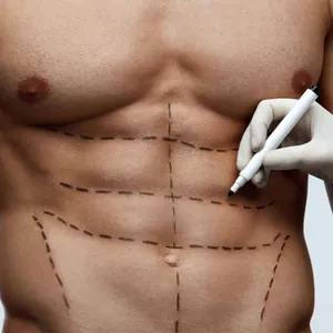 Definição Abdominal 