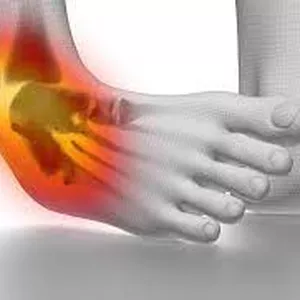 Cover image for Ebook Ankle Sprain Recovery Guide