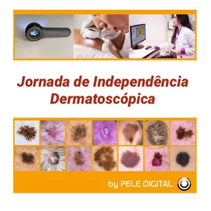 Imagem principal do produto Independência Dermatoscópica