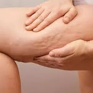 Imagen de portada para Ebook Programa anticelulitis (ebook + plan 30 días) España