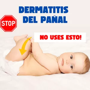 Imagen de portada para Curso online DERMATITIS DEL PAÑAL:  Cómo prevenir y cómo tratar la Pañalitis