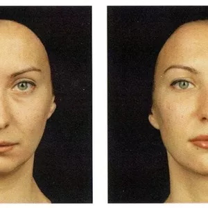 Imagem de capa para o Curso online Soft Lift