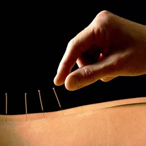 Imagem de capa para o Evento presencial Z Curso de Dry Needling, Eletro Dry Needling e Magnetoterapia - Agulhamento na Dor, 06 e 13 de Agosto de 2021, 2 Sextas Feiras, 08h às 18h, Méier RJ