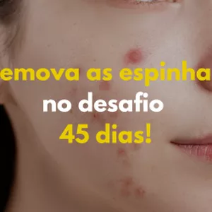 Imagem de capa para o Ebook Remova espinhas no desafio 45 dias