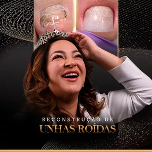 Imagem de capa para o Curso online RECONSTRUÇÃO DE UNHAS ROÍDAS