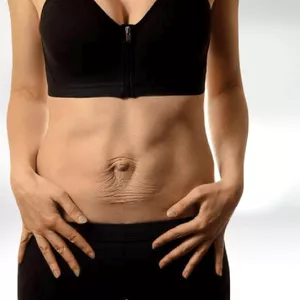 Imagem de capa para o Curso online Diástase Redux 