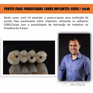 Imagem de capa para o Curso online PONTES FIXAS PARAFUSADAS SOBRE IMPLANTES: Cerec/inLab