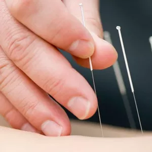 Imagen de portada para Ebook Acupuntura de Rodilla y otros..