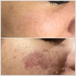 Imagem de capa para o Curso online Além das fórmulas