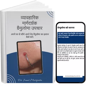 Imagen de portada para Ebook व्यावहारिक मार्गदर्शक ग्रैनुलोमा उपचार