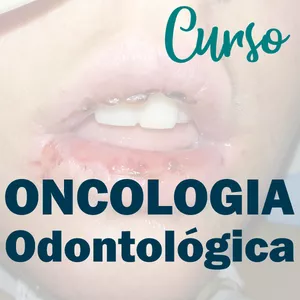 Imagem principal do produto Odontologia Oncológica - Base para diagnóstico e tratamento odontológico do paciente oncológico