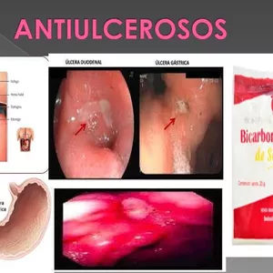 Imagen de portada para Ebook FÁRMACOS-PDF (Antiulcerosos y Antiacidos) Enfermeria-2024